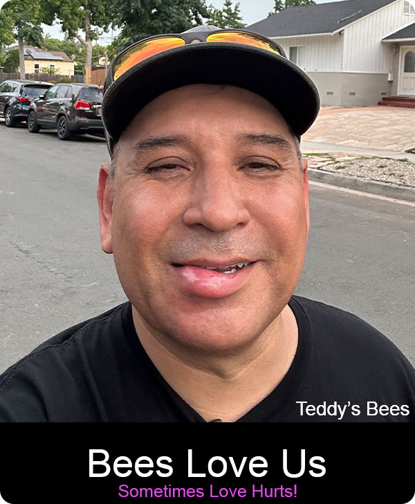 picture of a teddys bee removal service technician with a swollen lip from a bee sting. Ouch!